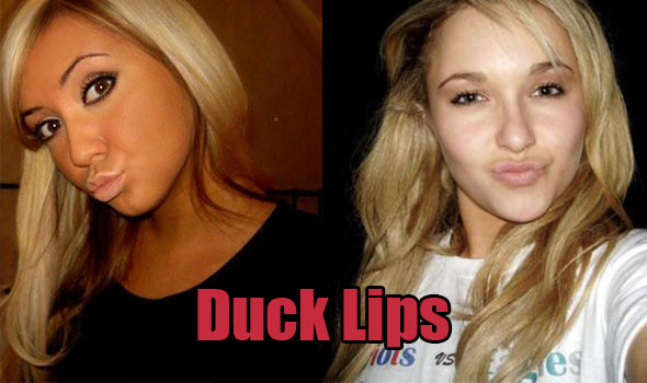 duck-lips-pics